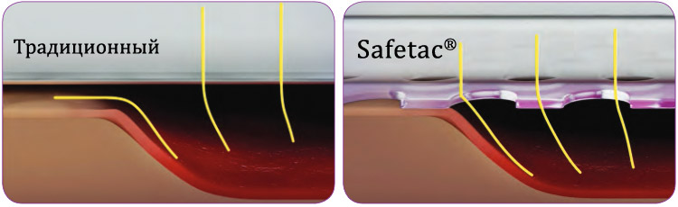 Контактный слой Safetac® предотвращает растекание экссудата из раны